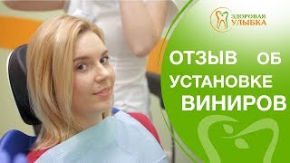 Виниры на кривые зубы. ?Отзыв об установке виниров на кривые зубы. Здоровая улыбка. 12+