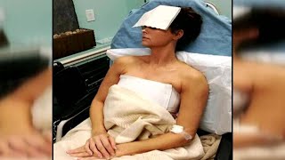 More women removing breast implants, doctors say