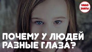 Почему у людей разные глаза?