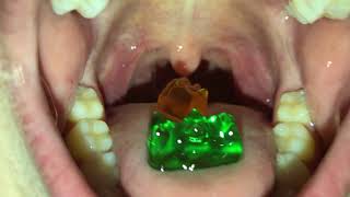 Vore