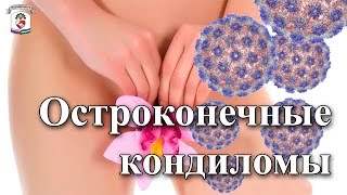 "На приеме у врача" Выпуск 16 - Остроконечные кондиломы