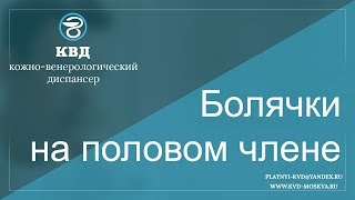 299  Болячки на половом члене