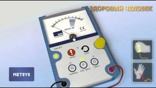 Metsys Диагностика рака. Здоровый человек.
