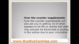 Causes of Edema in Feet and Ankles