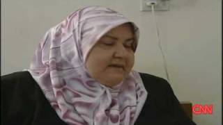 Iraq amputee walks again