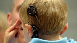 Реабилитация детей после кохлеарной имплантации в Алматы