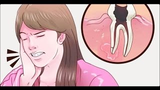Como Acabar Com  A Dor De Dente Em 1Minuto Usando Apenas 2 Ingredientes