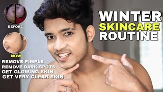 The Best Winter Skin Care Routine In Budget | Best Skin Care Routine For Indian Mens And Boys