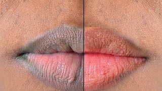 Get Baby Soft Pink Lips in Just 1 Day Naturally at Home (Easy and 100% Works)