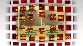 Трофическая язва. трофическая язва на ноге лечение мазью с серебром