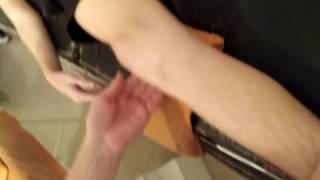 Patella Dislocation.Вывих надколенника.Репозиция.
