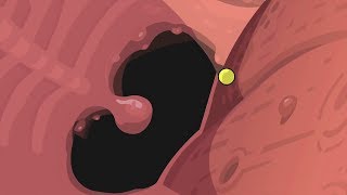 Robot whale noms (H1 S01E19)
