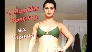 2 Months Post-Op Update