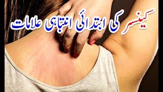12 Early Warning Signs of Cancer Most People Ignore# Cancer ki Alamat in Urdu | کینسر کی علامات