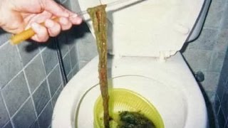 تخلص من السحر المأكول بنفسك في دقايق