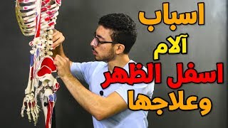 5حاجات بتسبب آلام اسفل الظهر وعلاجها  low back pain