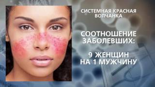 Системная красная волчанка