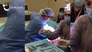 İkiz Bebek Doğum Anı | Prof. Dr. Ulun Uluğ