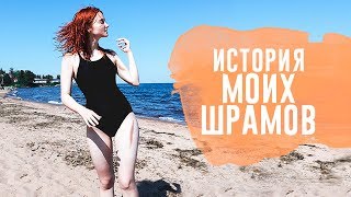 История моих шрамов.