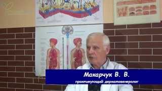 Стригущий лишай ( Микроспория ) у детей и беременных