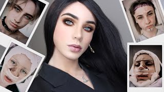 I’m alive! 9 months post-op face reveal + answering your plastic surgery questions!!