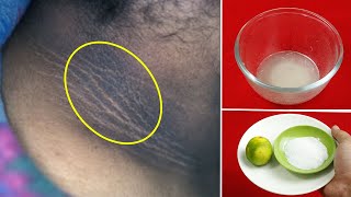 CUKUP 5 MENIT OLESKAN RACIKAN INI, LEHER HITAM LANGSUNG LENYAP - CARA MEMUTIHKAN LEHER YANG HITAM