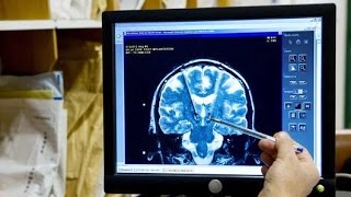 Как лечить и вылечить опухоль мозга
