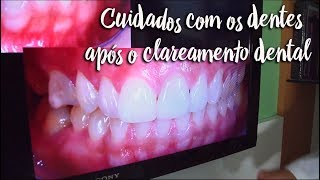 Fica a Dica - Cuidados com os dentes após o clareamento dental - by Farmácias Pague Menos