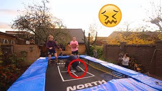 injured myself on a bad trampoline accident...