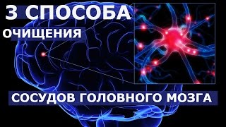 3 способа очищения сосудов головного мозга народными средствами.