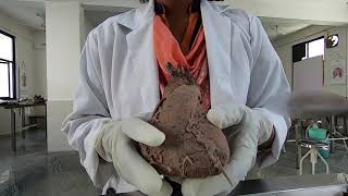 EXTERNAL FEATURES OF HUMAN HEART | ANATOMY | CADAVERIC DISSECTION