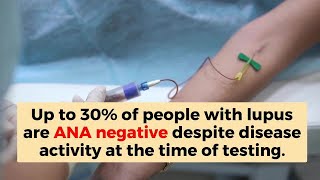 Time to rethink ANA as a lupus biomarker?
