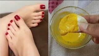 पैरो में सालों साल जमी मैल गंदगी बदबू मिनटों में साफ कर गोरा बनाए | FEET WHITENING BLEACH At Home