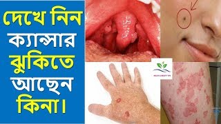 যে ১০ টি লক্ষণ দেখা দিলে বুঝতে হবে ক্যান্সার ঝুকিতে আছেন || Cancer Symptoms And Treatment || Cancer#