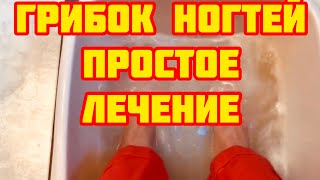 Как вылечить Грибок ногтей за копейки!!!!!