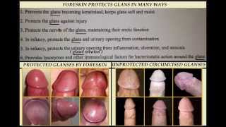 Human penis part 4 : Foreskin Section 2 Functions of Foreskin. 18+ Educational purposes only .