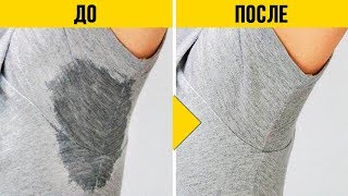СИЛЬНАЯ ПОТЛИВОСТЬ ИСЧЕЗНЕТ НАВСЕГДА! Попробуй ЭТИ эффективные СПОСОБЫ
