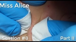 Miss Alice: Session #8 - Part 2 (of 3)