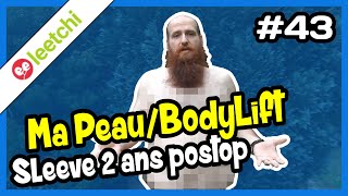 ❰MA PEAU - BODYLIFT - 2 ANS POST OP SLEEVE❱ La Sleeve d'un Barbu #043