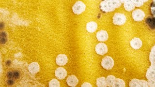 How to Remove Mildew from Fabric - Mildew And Mold Removal