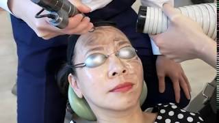 HOLLYWOOD PEEL (SPECTRA XT LASER)