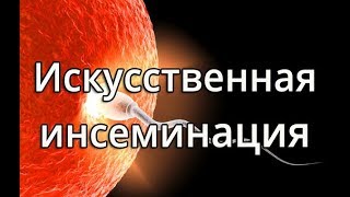 Внутриматочная инсеминация