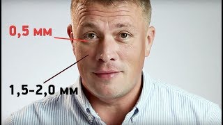 Темные круги и отеки под глазами. Печерский офтальмологический центр.