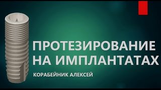 После имплантации.  Протезирование на имплантах.