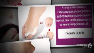 valgus pro отзывы

  - Уникальный фиксатор Valgus Pro