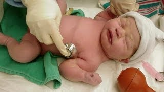 Baby Boys Should Be Circumcised, Says Pediatrics Group