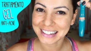 L'Oréal Pure Zone - Gel tratamento anti acne