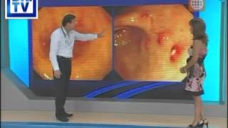La Gastritis - qué es, causas, síntomas y tratamiento