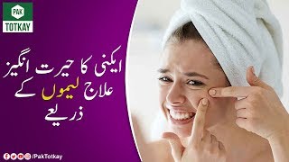 Acne Ka Hairat Angez Ilaj Leemu Kay Zariye | Pak Totkay
