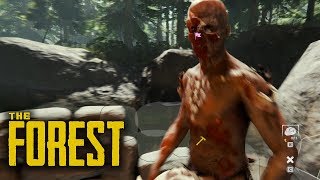 THE FOREST ? LOGGIA mit Wohlfühlcharakter!  | #11